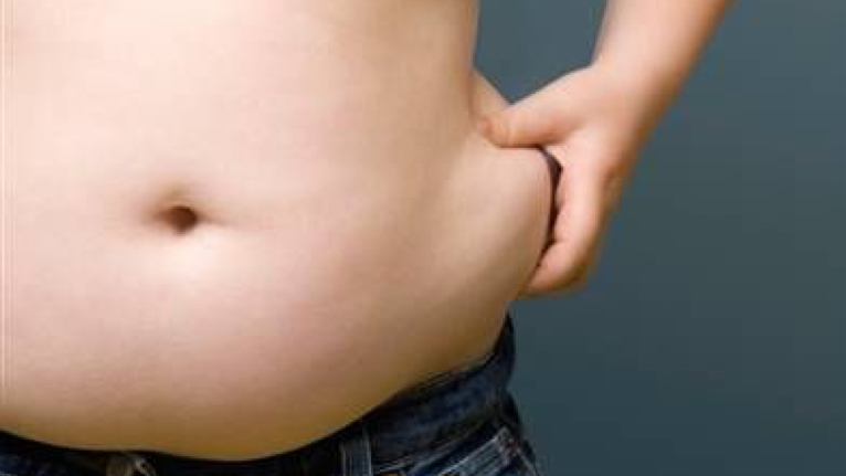 Παιδική παχυσαρκία